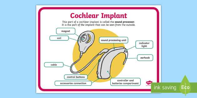 parts of a cochlear implant diagram