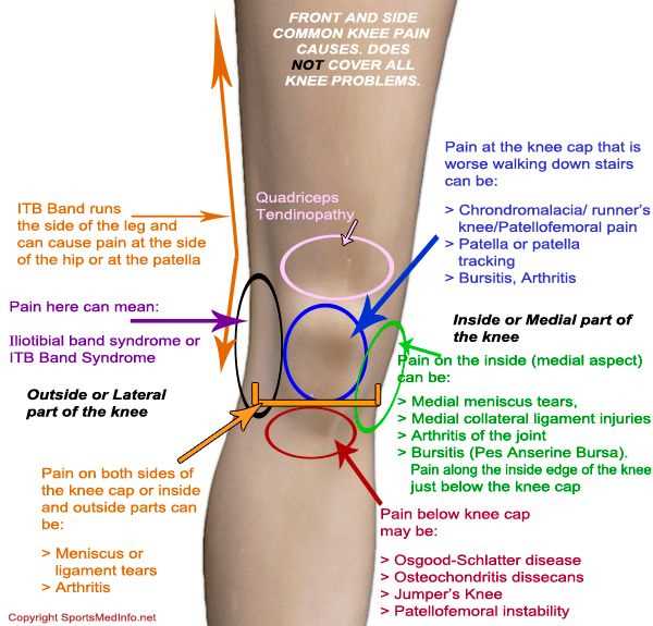 knee parts diagram