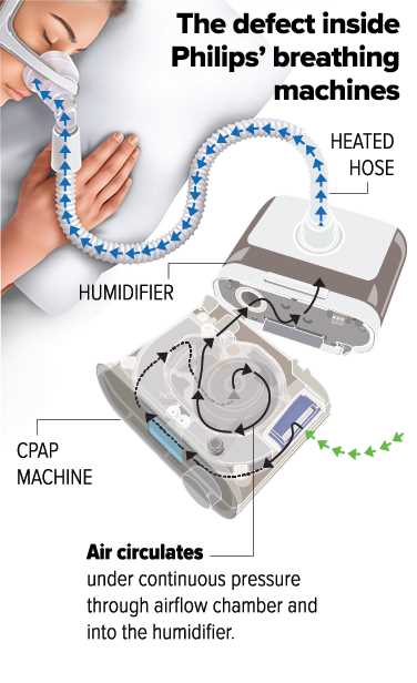 philips dreamstation parts diagram